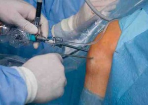 Knee Surgeon Scottsdale