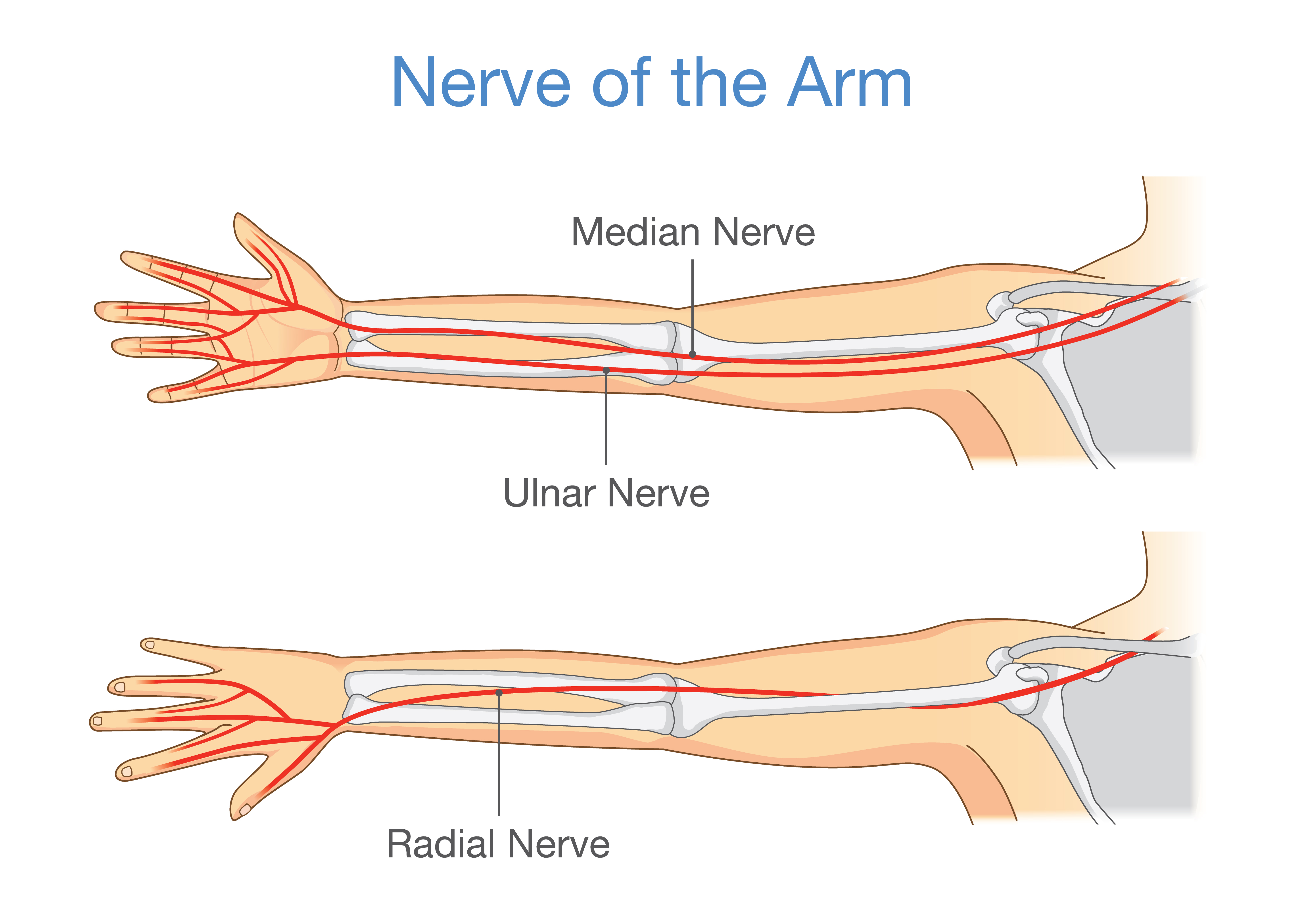 What Is Ulnar Neuritis